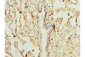 Immunohistochemistry of paraffin-embedded human lung tissue using ABIN7170672 at dilution of 1:100 (SLA Antikörper  (AA 2-276))