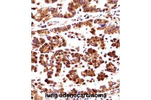 Immunohistochemistry (IHC) image for anti-Origin Recognition Complex, Subunit 3 (ORC3) antibody (ABIN2998313)