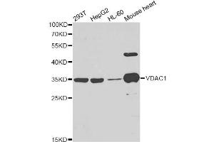 Western blot analysis of extracts of various cell lines, using VDAC1 antibody. (VDAC1 Antikörper)