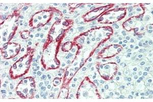 Detection of NEU in Human Spleen Tissue using Polyclonal Antibody to Neuraminidase (NEU)