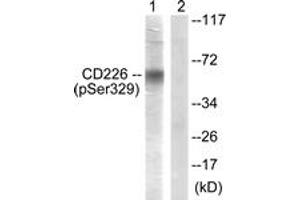 Western blot analysis of extracts from COS7 cells, using CD226/DNAM-1 (Phospho-Ser329) Antibody. (CD226 Antikörper  (pSer329))