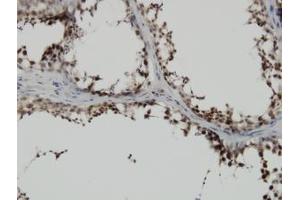 Image no. 1 for anti-PDZ Binding Kinase (PBK) (AA 1-110) antibody (ABIN599272) (PBK Antikörper  (AA 1-110))