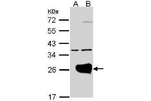 WB Image Western Blot analysis of RAB1A expression in transfected 293T cell line by RAB1A polyclonal antibody. (RAB1A Antikörper)