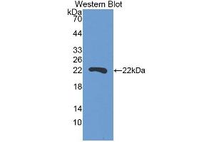 Detection of Recombinant SBSN, Human using Polyclonal Antibody to Suprabasin (SBSN) (Suprabasin Antikörper  (AA 434-590))