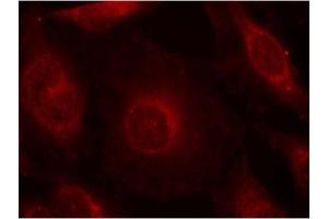 Image no. 2 for anti-V-Akt Murine Thymoma Viral Oncogene Homolog 1 (AKT1) (pTyr312), (pTyr315), (pTyr316) antibody (ABIN319269) (AKT1 Antikörper  (pTyr312, pTyr315, pTyr316))