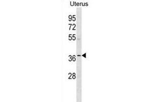 OR5W2 Antibody (C-term) (ABIN1881607 and ABIN2838752) western blot analysis in human Uterus tissue lysates (35 μg/lane). (OR5W2 Antikörper  (C-Term))
