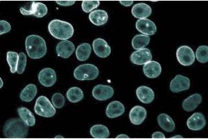 Immunofluorescence staining of HeLa cells (Human cervical epitheloid carcinoma, ATCC CCL-2. (Thymopoietin Antikörper  (AA 34-156))