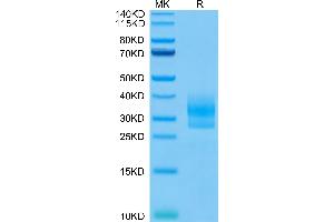 Human SOST on Tris-Bis PAGE under reduced condition. (Sclerostin Protein (SOST) (AA 24-213) (His-Avi Tag))