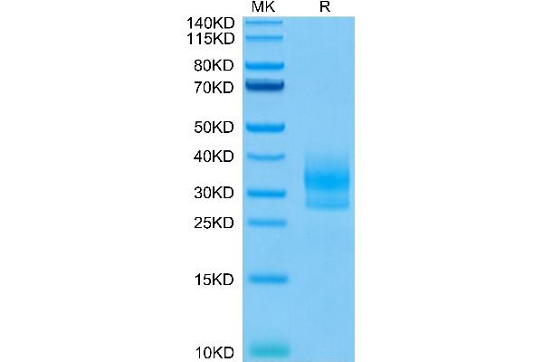 Sclerostin Protein (SOST) (AA 24-213) (His-Avi Tag)