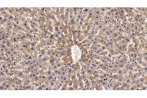 Immunohistochemistry (IHC) image for anti-Vascular Endothelial Growth Factor A (VEGFA) (AA 27-190) antibody (ABIN7429451)