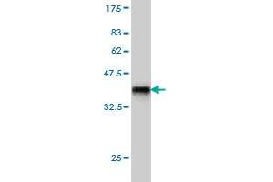 Western Blot detection against Immunogen (36. (INPPL1 Antikörper  (AA 1159-1258))