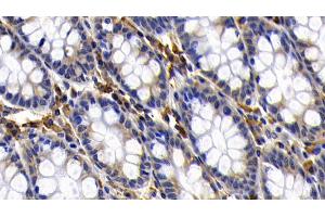 Immunohistochemistry (IHC) image for anti-BCL2-Like 1 (BCL2L1) (AA 2-212) antibody (ABIN7437179)