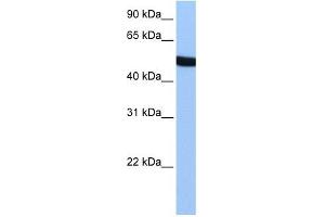 SPATA6 antibody used at 1 ug/ml to detect target protein. (SPATA6 Antikörper  (Middle Region))