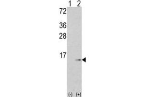 Western Blotting (WB) image for anti-S100 Calcium Binding Protein A6 (S100A6) antibody (ABIN3003159)