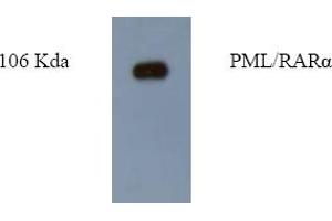 Western Blotting (WB) image for anti-Promyelocytic Leukemia (PML) antibody (ABIN452172) (PML Antikörper)