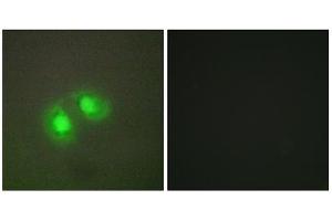 Immunofluorescence analysis of A549 cells, using TOP2A antibody. (Topoisomerase II alpha Antikörper  (N-Term))