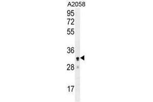 UBXN2A Antibody (C-term) western blot analysis in A2058 cell line lysates (35 µg/lane). (UBXN2A Antikörper  (C-Term))