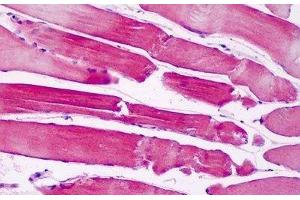 Human Skeletal Muscle: Formalin-Fixed, Paraffin-Embedded (FFPE) (PAK6 Antikörper  (AA 268-297))