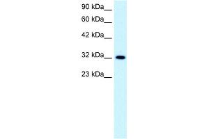 WB Suggested Anti-E2F5 Antibody Titration:  0. (E2F5 Antikörper  (N-Term))