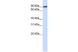Western Blotting (WB) image for anti-DNA Cross-Link Repair 1C (DCLRE1C) antibody (ABIN2459465) (DCLRE1C Antikörper)