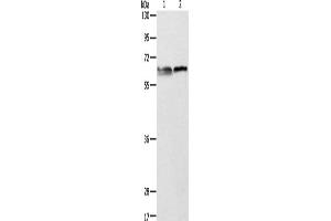 Western Blotting (WB) image for anti-Aminolevulinate, delta-, Synthase 2 (ALAS2) antibody (ABIN2422513)