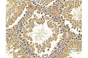 ABIN7095701 and ABIN7099763 at 1/100 staining rat testis tissue by IHC-P. (SLC13A3 Antikörper)