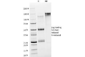 SDS-PAGE Analysis Purified NSE gamma Mouse Monoclonal Antibody (NSE-P2). (ENO2/NSE Antikörper  (AA 416-433))