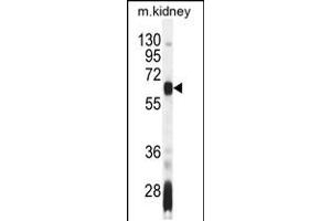 Western blot analysis in mouse kidney tissue lysates (35ug/lane). (AIRE Antikörper  (AA 64-92))