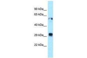 Image no. 1 for anti-Thioredoxin-Related Transmembrane Protein 1 (TMX1) (C-Term) antibody (ABIN6747966) (TMX1 Antikörper  (C-Term))