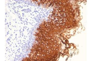 Formalin-fixed, paraffin-embedded human Skin stained with Cytokeratin 10 Mouse Monoclonal Antibody (AE20).