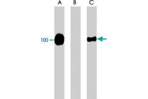 Western blot of Jurkat cells expressing CFL1. (Cofilin Antikörper  (pSer3))