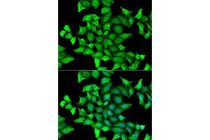 Immunofluorescence analysis of HeLa cells using SEPSECS antibody. (SEPSECS Antikörper)