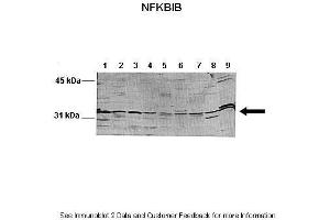 Lanes:   Lane 1: 100ug mouse liver lysate  Lane 2: 100ug mouse brain lysate  Lane 3: 100ug mouse heart lysate  Lane 4: 100ug mouse kidney lysate  Lane 5: 100ug mouse lung lysate  Lane 6: 100ug mouse thymus lysate  Lane 7: 100ug mouse spleen lysate  Lane 8: 100ug mouse testis lysate  Lane 9: 100ug HeLa cell lysate   Primary Antibody Dilution:   1:1000  Secondary Antibody:   Anti-rabbit-AP  Secondary Antibody Dilution:   1:10,000  Gene Name:   NFKBIB  Submitted by:   Andreia Carvalho. (NFKBIB Antikörper  (N-Term))