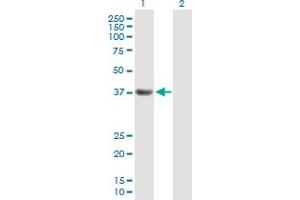 Western Blot analysis of PDS5A expression in transfected 293T cell line by PDS5A MaxPab polyclonal antibody. (PDS5A Antikörper  (AA 1-333))