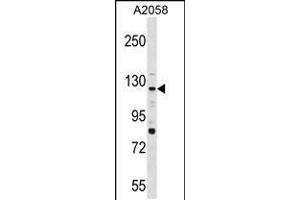 Western blot analysis in A2058 cell line lysates (35ug/lane). (PTPRN2 Antikörper  (N-Term))