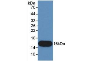 Detection of Recombinant CTGF, Human using Monoclonal Antibody to Connective Tissue Growth Factor (CTGF) (CTGF Antikörper  (AA 80-200))