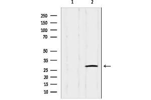 Western blot analysis of lysates from Hybridoma cells, using IGFBPL1 Antibody. (IGFBPL1 Antikörper  (Internal Region))