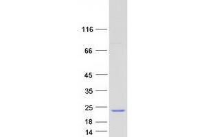Western Blotting (WB) image for Mediator Complex Subunit 21 (MED21) protein (Myc-DYKDDDDK Tag) (ABIN2725739)