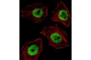 Fluorescent image of A549 cell stained with UBP1 Antibody . (UBP1 Antikörper  (AA 266-295))