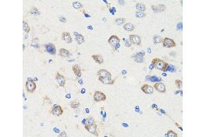 Immunohistochemistry of paraffin-embedded Rat brain using DLG1 Polyclonal Antibody at dilution of 1:100 (40x lens). (DLG1 Antikörper)