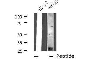 Western blot analysis of extracts from HT-29 cells, using ZFYVE19 antibody. (ZFYVE19 Antikörper  (Internal Region))