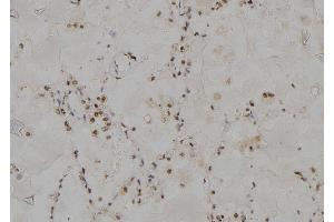 ABIN6264480 and ABIN6277000 at 1/100 staining Human lung tissue by IHC-P.