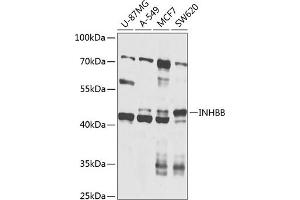 Western blot analysis of extracts of various cell lines, using INHBB antibody (ABIN6129033, ABIN6142461, ABIN6142462 and ABIN6224649) at 1:1000 dilution. (INHBB Antikörper  (AA 293-407))