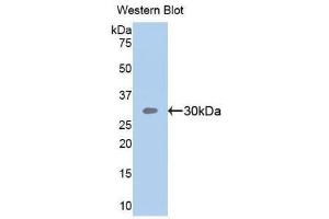 Western Blotting (WB) image for anti-Sema Domain, Seven Thrombospondin Repeats (Type 1 and Type 1-Like), Transmembrane Domain (TM) and Short Cytoplasmic Domain, (Semaphorin) 5B (SEMA5B) (AA 350-602) antibody (ABIN1860526) (SEMA5B Antikörper  (AA 350-602))