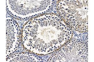 ABIN7096340 and ABIN7100402 at 1/100 staining rat testis tissue by IHC-P.