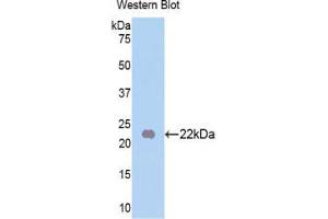 Western blot analysis of the recombinant protein. (FGF13 Antikörper  (AA 63-245))