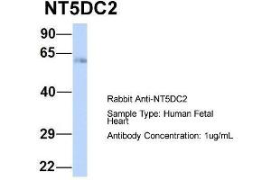 Host:  Rabbit  Target Name:  NT5DC2  Sample Type:  Human Fetal Heart  Antibody Dilution:  1. (NT5DC2 Antikörper  (N-Term))