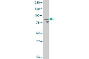 ADAM30 polyclonal antibody (A01), Lot # 060106JC01 Western Blot analysis of ADAM30 expression in 293 . (ADAM30 Antikörper  (AA 199-298))