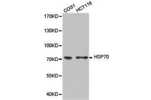 Western Blotting (WB) image for anti-Heat Shock Protein 70 (HSP70) antibody (ABIN1873094) (HSP70 Antikörper)