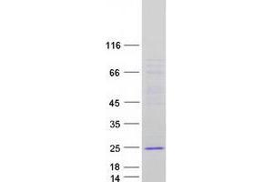 Western Blotting (WB) image for Thymocyte Nuclear Protein 1 (THYN1) (Transcript Variant 2) protein (Myc-DYKDDDDK Tag) (ABIN2733664)